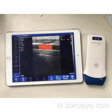 Handheld draadloze echografie voor telefoon en pad